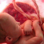 Avortul a devenit principala cauză de deces în lume în anul 2025, – statistica OMS